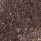 Immunohistochemical staining of human lymph node using Anti-VPS37B antibody HPA038217.