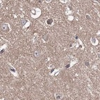 Immunohistochemical staining of human cerebral cortex using Anti-VPS37B antibody HPA038217.