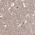 Immunohistochemical staining of human cerebral cortex using Anti-VPS37B antibody HPA038217.