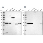 Western blot analysis using Anti-VPS37B antibody HPA038217 (A) shows similar pattern to independent antibody HPA038218 (B).