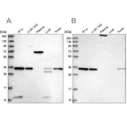 Western blot analysis using Anti-VPS37B antibody HPA038217 (A) shows similar pattern to independent antibody HPA038218 (B).