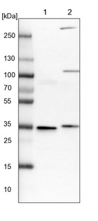 Lane 1: NIH-3T3 cell lysate (Mouse embryonic fibroblast cells)_br/_Lane 2: NBT-II cell lysate (Rat Wistar bladder tumour cells)