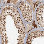 Immunohistochemical staining of human testis shows strong nuclear positivity in cells in seminiferous ducts.