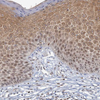 Immunohistochemical staining of human skin shows moderate nuclear and cytoplasmic positivity in squamous epithelial cells.