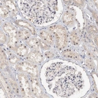 Immunohistochemical staining of human kidney shows weak nuclear positivity in cells in tubules.