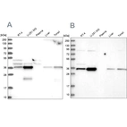 Western blot analysis using Anti-GPATCH11 antibody HPA038232 (A) shows similar pattern to independent antibody HPA038231 (B).