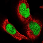 Immunofluorescent staining of human cell line U-251 MG shows localization to nucleus.