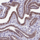 Immunohistochemical staining of human Fallopian tube shows moderate nuclear positivity in glandular cells.