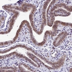Immunohistochemical staining of human Fallopian tube shows moderate nuclear positivity in glandular cells.