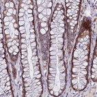 Immunohistochemical staining of human rectum shows moderate nuclear and nucleolar positivity in glandular cells.