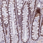 Immunohistochemical staining of human rectum shows moderate nuclear and nucleolar positivity in glandular cells.