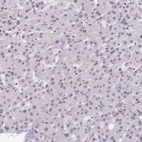 Immunohistochemical staining of human liver shows very low positivity in hepatocytes.