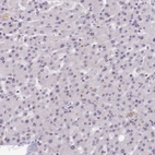 Immunohistochemical staining of human liver shows very low positivity in hepatocytes.