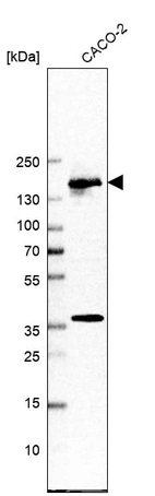 Western blot analysis in human cell line CACO-2.