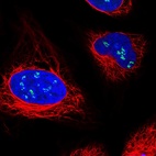 Immunofluorescent staining of human cell line U-2 OS shows localization to nucleoli fibrillar center.