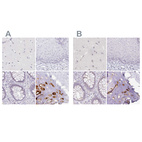 Anti-ACAN Antibody