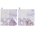 Anti-ACAN Antibody