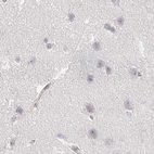 Immunohistochemical staining of human cerebral cortex using Anti-ACAN antibody HPA038242.
