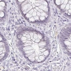 Immunohistochemical staining of human rectum using Anti-ACAN antibody HPA038241.