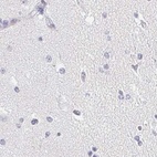 Immunohistochemical staining of human cerebral cortex using Anti-ACAN antibody HPA038241.