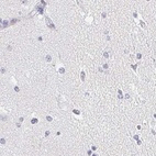 Anti-ACAN Antibody