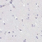 Immunohistochemical staining of human cerebral cortex using Anti-ACAN antibody HPA038241.