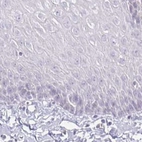Immunohistochemical staining of human esophagus using Anti-ACAN antibody HPA038242.