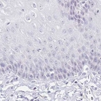 Immunohistochemical staining of human esophagus using Anti-ACAN antibody HPA038241.