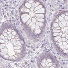 Immunohistochemical staining of human rectum using Anti-ACAN antibody HPA038242.