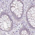 Immunohistochemical staining of human rectum using Anti-ACAN antibody HPA038242.