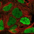 Immunofluorescent staining of human cell line HEK 293 shows localization to nucleoplasm.