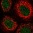 Immunofluorescent staining of human cell line A-431 shows localization to nucleoplasm.