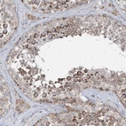 Anti-CHCHD5 Antibody