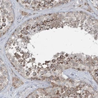 Anti-CHCHD5 Antibody