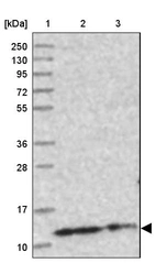 Lane 1: Marker [kDa] 250, 130, 95, 72, 55, 36, 28, 17, 10_br/_Lane 2: Human cell line RT-4_br/_Lane 3: Human cell line U-251MG sp