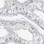 Immunohistochemical staining of human testis shows strong positivity in nuclear membrane in a subset of cells in seminiferous ducts.
