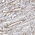 Immunohistochemical staining of human kidney shows strong positivity in nuclear membrane in cells in tubules.