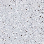 Immunohistochemical staining of human liver shows no positivity in nuclear membrane in hepatocytes as expected.