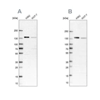 Western blot analysis using Anti-PRPF40A antibody HPA038273 (A) shows similar pattern to independent antibody HPA038272 (B).