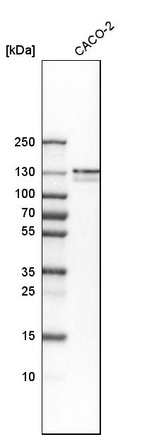 Western blot analysis in human cell line CACO-2.