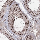 Anti-PRPF40A Antibody