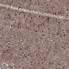 Immunohistochemical staining of human cerebral cortex shows strong nuclear positivity in neuronal cells.