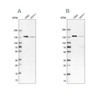 Western blot analysis using Anti-PRPF40A antibody HPA038272 (A) shows similar pattern to independent antibody HPA038273 (B).