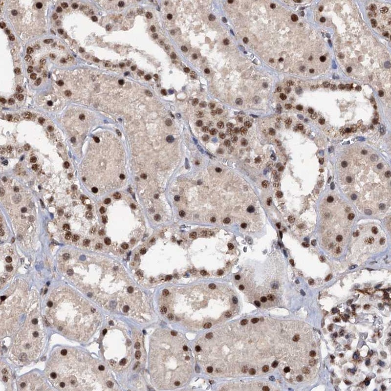 Anti-TBC1D12 Antibody