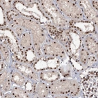 Anti-TBC1D12 Antibody
