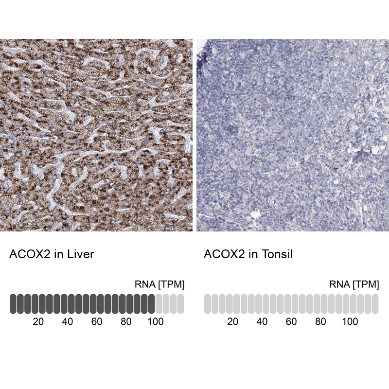 Anti-ACOX2 Antibody
