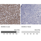 Anti-ACOX2 Antibody