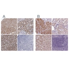 Immunohistochemical staining of human heart muscle, kidney, liver and tonsil using Anti-ACOX2 antibody HPA038280 (A) shows similar protein distribution across tissues to independent antibody HPA064845 (B).