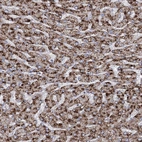 Immunohistochemical staining of human liver shows moderate granular cytoplasmic positivity in hepatocytes.