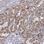 Anti-ACOX2 Antibody